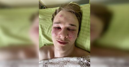 Він сам себе побив та був під наркотиками: військкомат виправдався за спробу самогубства хлопця у ТЦК