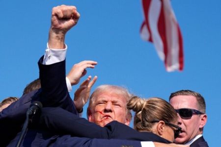 Замах на Трампа: лікар оцінив тяжкість травми політика