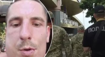Одесит розповів, як поліцейські зламали йому щелепу, поки везли до ТЦК
