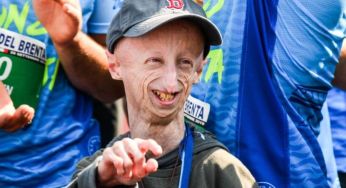 Учений намагався зупинити передчасне старіння і помер у 28 років: який вигляд він мав (фото)