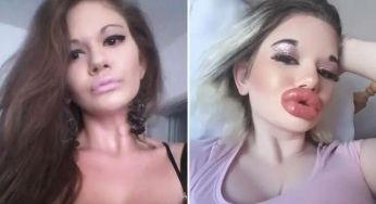 Жінка з найбільшими губами у світі хоче бути схожа на ляльку
