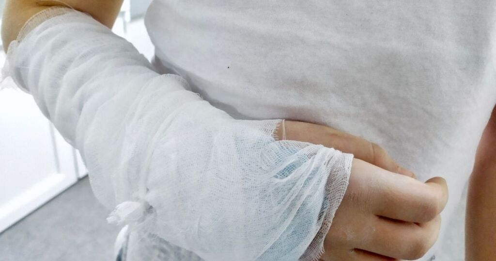 Дослідники створили кістковий “суперклей”, який за лічені хвилини зрощує переломи