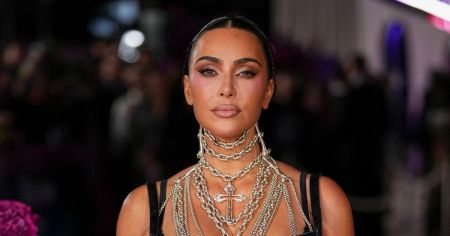 У 45-річної Кім Кардашян діагностували аневризму головного мозку