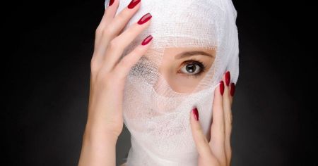 Жінка зробила 400 процедур пластичної хірургії та косметології: фото до і після