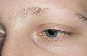 У Росії у жінок масово випадають брови