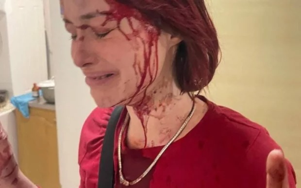 Працівник ТЦК жорстоко побив дівчину: суд фактично закрив очі на злочин