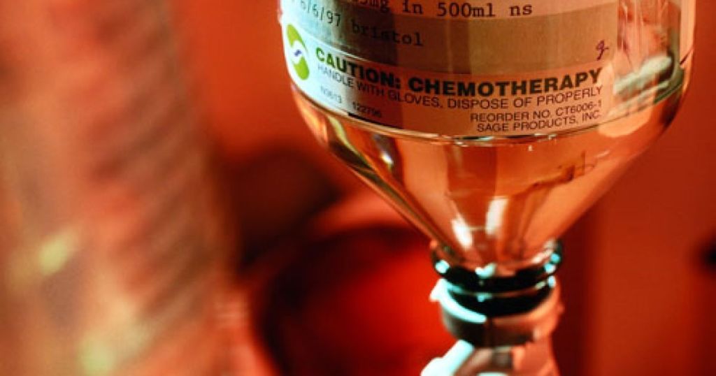 Пацієнту з онкологією призначили 8 років хіміотерапії: до чого це призвело