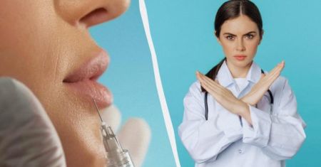 Не цілуватися і не ходити до стоматолога: лікарка назвала несподівані заборони після збільшення губ Фото з відкритих джерел