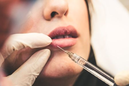 Ботокс без секретів: голлівудські зірки, які більше не приховують ін’єкції краси Ботокс / © unsplash.com