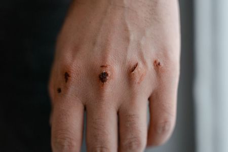Сепсис / © pexels.com